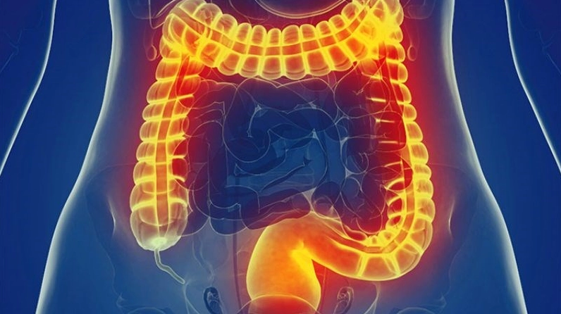 Cà phê có thể gây kích thích hoạt động của ruột kết, có thể dẫn đến tiêu chảy