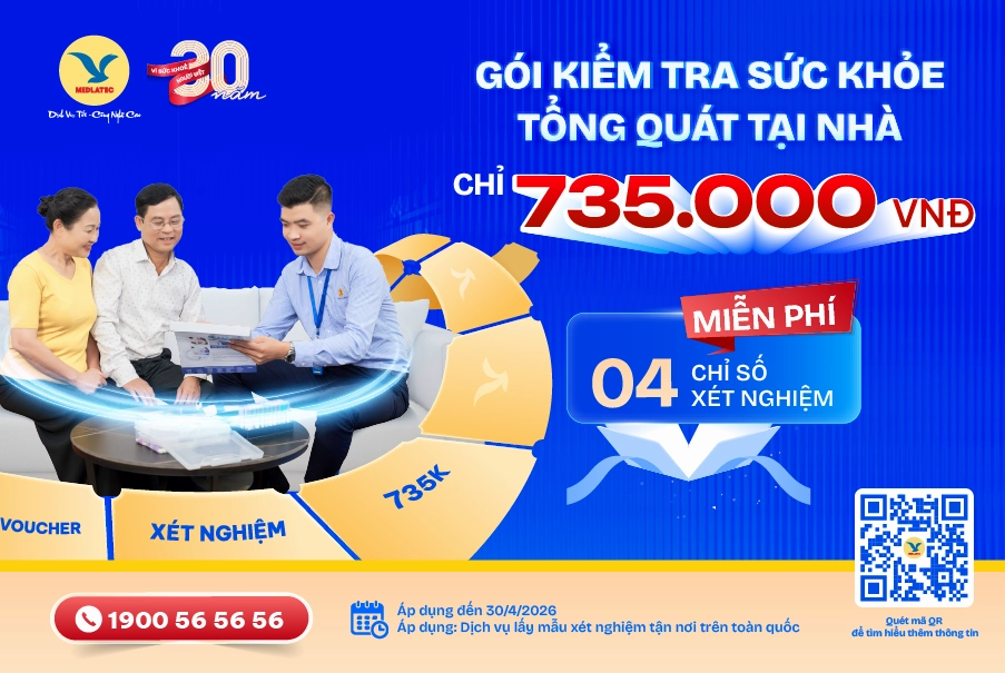 cà phê giảm cân