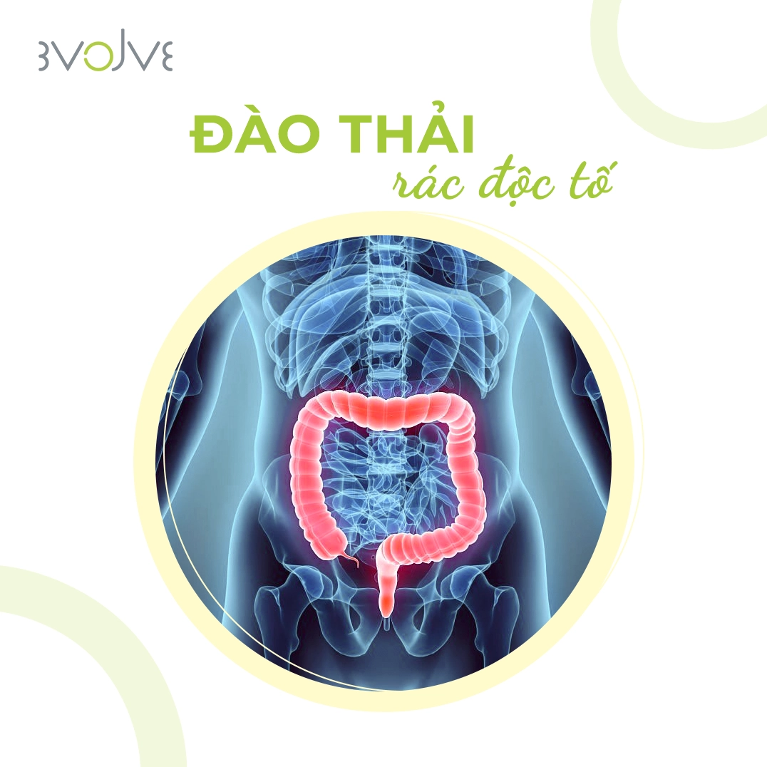 ĐÀO THẢI RÁC ĐỘC TỐ: Giảm ít nhất 2kg cặn bã, độc tố bám trên thành đại tràng ra khỏi cơ thể sau nhiều năm tích tụ