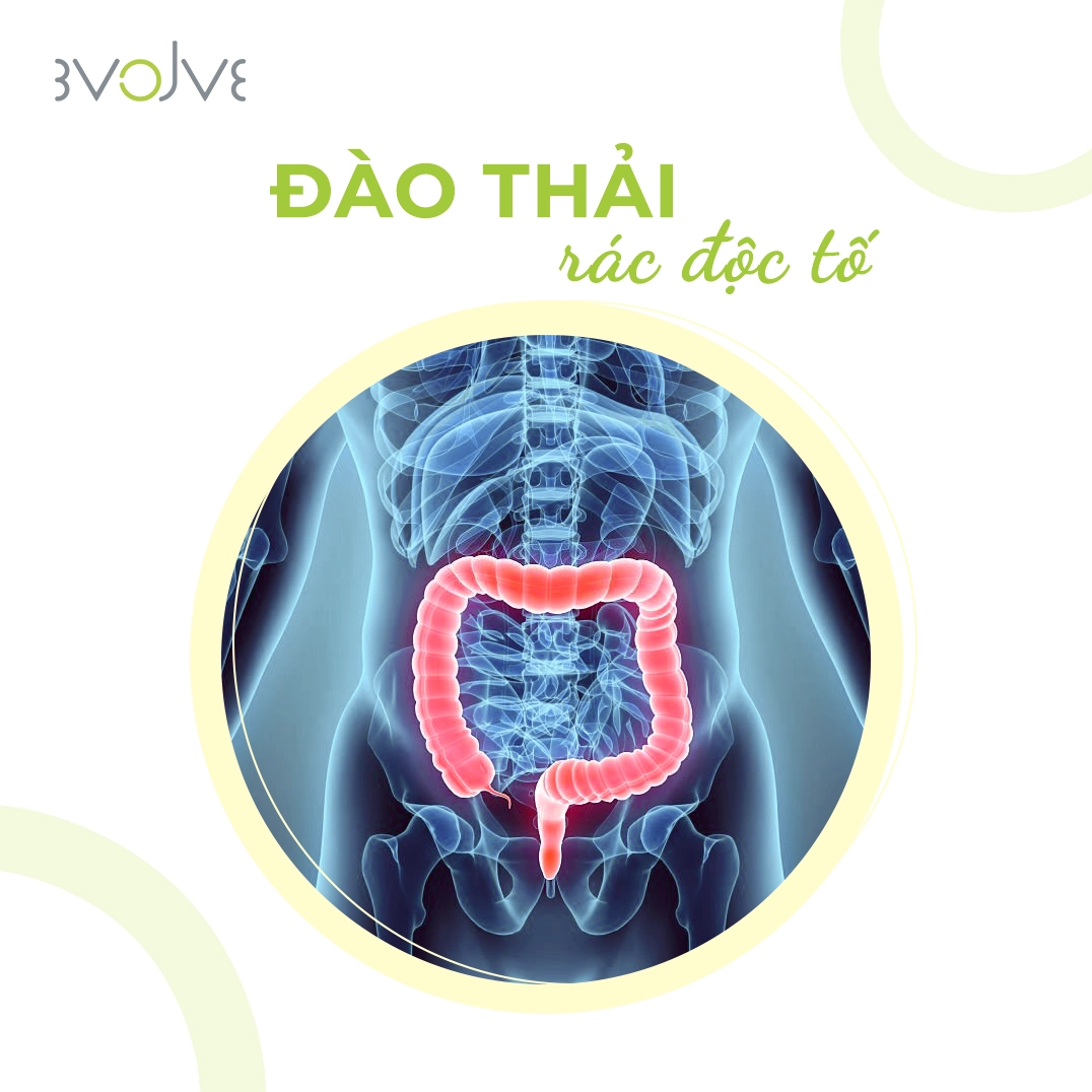 ĐÀO THẢI RÁC ĐỘC TỐ: Giảm ít nhất 2kg cặn bã, độc tố bám trên thành đại tràng ra khỏi cơ thể sau nhiều năm tích tụ