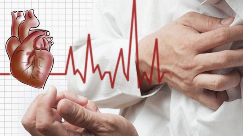 Uống cà phê lượng vừa phải giúp mạch máu giãn nở tránh nguy cơ đột quỵ